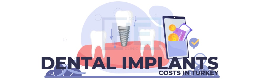 Dental implants Costs in Turkey