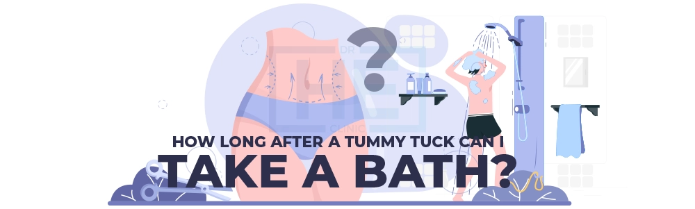 How Long After A Tummy Tuck Can I Take A Bath?