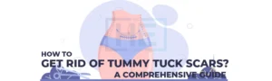 How To Get Rid Of Tummy Tuck Scars?