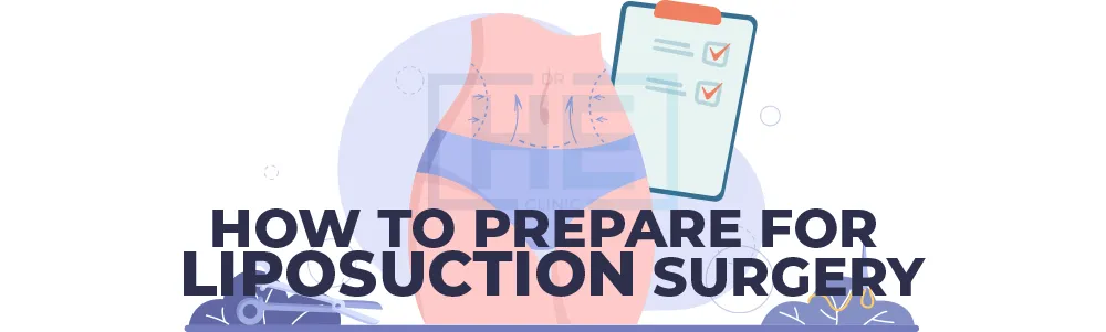 How to Prepare for Liposuction Surgery?